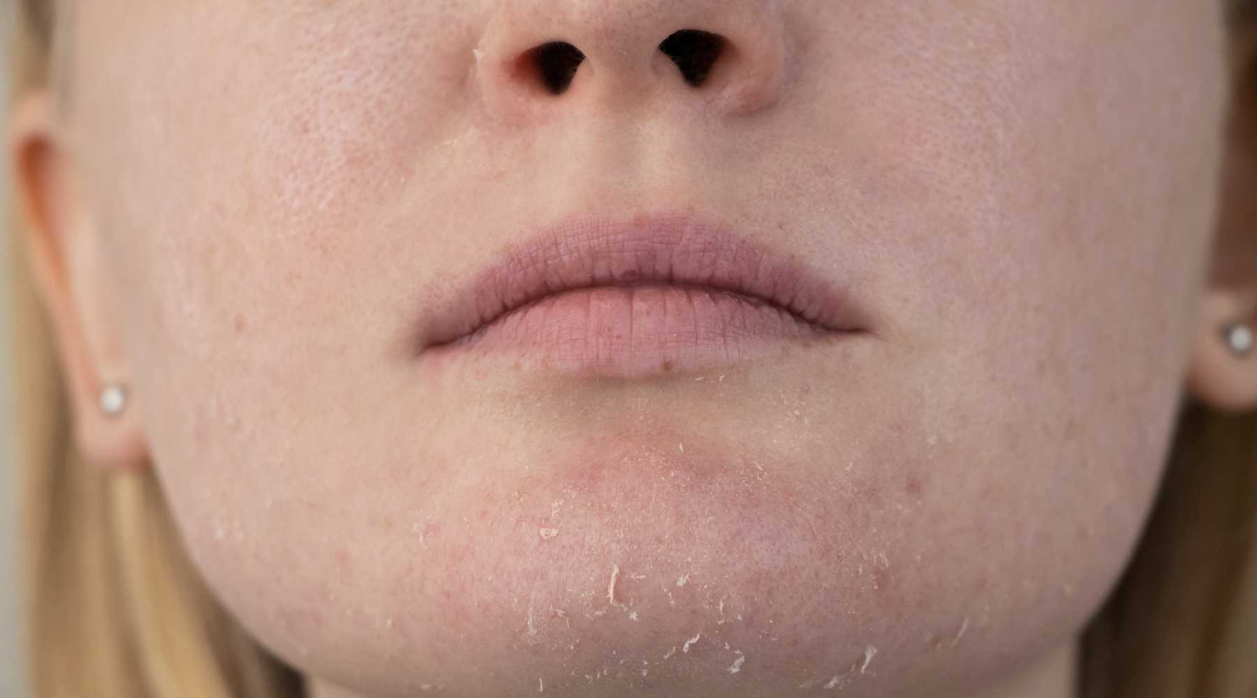 How Long Should You Sauna Sauna Benefits For Skin? Clearlight® Saunas